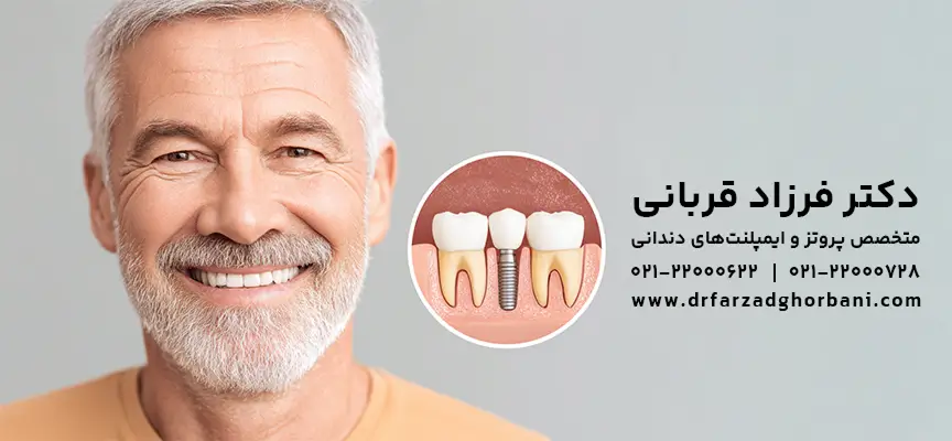 بهترین دندانپزشک متخصص ایمپلنت در تهران-دکترفرزاد قربانی