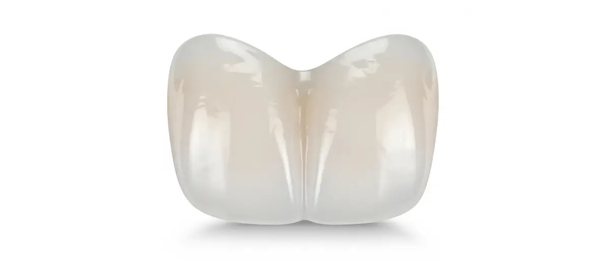 روکش دندانی- دکتر فرزاد قربانی